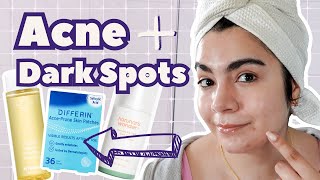 Im Breaking Out Routine for Breakouts and Hyperpigmentation [upl. by Talanta]