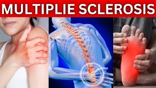 12 Early Warning Signs of Multiple Sclerosis You Shouldnt Ignore MS [upl. by Odom]