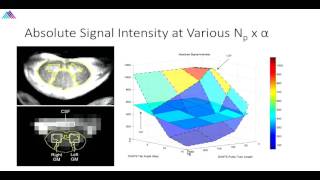 6th Annual TMII Symposium  2016  Session I  Neuroimaging  Dr Alan Seifert [upl. by West442]