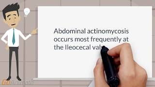 Where does abdominal actinomycosis occur most frequently [upl. by Meris]