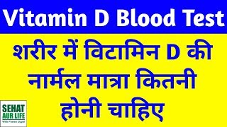 Vitamin D Blood Test Normal Range Hindi 25 Hydroxyvitamin D Test Normal Range Hindi [upl. by Ahsieat]