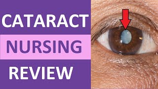 Cataracts Nursing NCLEX Eye Disorders Review  Cataracts Surgery Symptoms Medications [upl. by Shayn966]