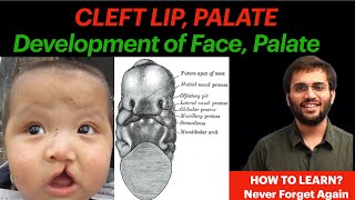 Development of Palate Face  Embryology  Cleft Lip Cleft Palate Video Human Embryology [upl. by Zak]