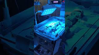 Low birth 28 week delivered babyNewborn Jaundice Treatment shortsviral viralvideo videos [upl. by Lauber600]