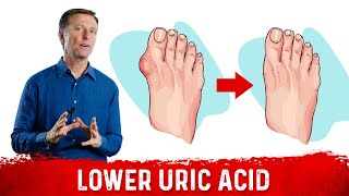 4 Ways to Neutralize Uric Acid [upl. by Nivlen]