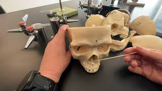 Skull Mandible and Maxilla bones and their bone markings [upl. by Treblihp]