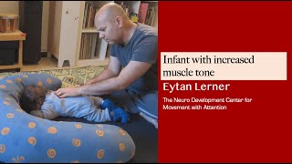 Infant with hypertonic muscle  Lesson by Eytan Lerner [upl. by Ozneral]