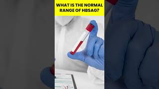 What is the normal range of HBsAg  HBsAg short shorts shortvideo [upl. by Ataymik]