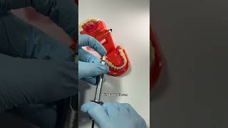 🔥 Extracting Hot or Infected Teeth  OnlineExodontiacom  dentist dentistry dentaltips [upl. by Church]