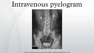 Intravenous pyelogram [upl. by Herm]