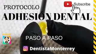 ✅ PROTOCOLO de Adhesión 👅 PASO a PASO [upl. by Kneeland]