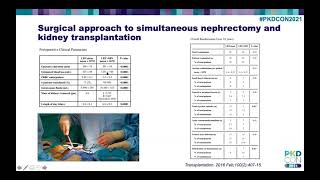 Nephrectomy surgery  understanding risks and benefits [upl. by Luna]