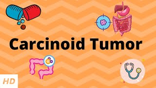 Carcinoid Tumor Causes Signs and Symptoms Diagnosis and Treatment [upl. by Aeel390]