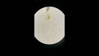 Strongyloides stercolaris en microscopio [upl. by Ahiel]