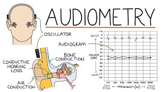 Understanding Audiometry and Audiograms [upl. by Olatha]