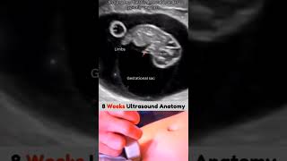 8 week ultrasound baby pregnant women viralshort love life [upl. by Anahpos]