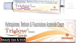 Triiglow cream honest review in hindi nalanda amp pigmetention amp pimple marks remove [upl. by Yrtneg]