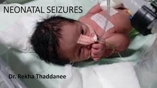 Neonatal Seizures  Pediatrics [upl. by Hourihan]