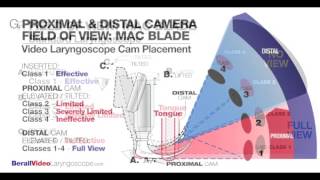 Intro to Video Laryngoscopy [upl. by Gallager]