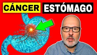 SÍNTOMAS PELIGROSOS DE CÁNCER ESTÓMAGO GÁSTRICO 💥 Causas Prevención y Tratamiento [upl. by Dann976]