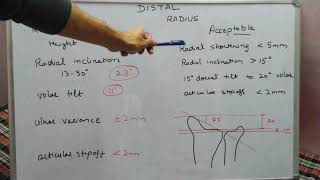 Distal Radius parameters [upl. by Asihtal]