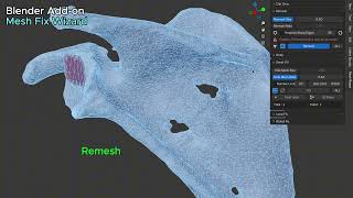 Blender Addon Tutorial Mesh Fix Wizard  Scapula CT Scan Segmentation  Clean Mesh [upl. by Dauf]