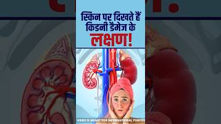 Kidney Damage Symptoms स्किन पर दिखते हैं किडनी डैमेज के ये लक्षण shorts ytshorts trending [upl. by Eralcyram772]