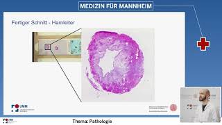 Schnellschnittdiagnostik  wann wofür und wie [upl. by Mair]