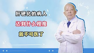 肝硬化的病人，达到什么程度，就不可医了 [upl. by Swithbart734]