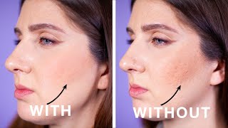 Simple Powder Trick For Pitted Acne Scars [upl. by April]