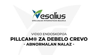 VESALIUS  PillCam® za debelo crevo Abnormalan nalaz Animacija [upl. by Revkah]