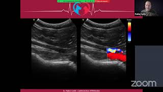 Webinar Ecocardiografia Doppler Veterinaria [upl. by Garrett225]