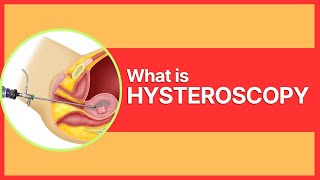 What is Hysteroscopy By Dr Mudita Jain [upl. by Selma296]