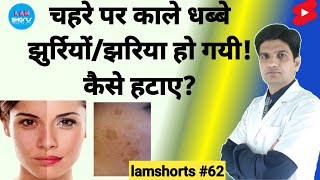 चहरे पर काले धब्बे झुर्रियों तथा झाइया हो गयी कैसे हटाए Shorts lamshorts [upl. by Ahseinat299]