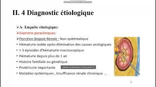 Diagnostic dune hématurie 2 [upl. by Nocaj126]