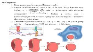 hereditary spherocytosis 1 [upl. by Ahseiyk]