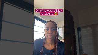 💧drinking water to heal eczema from the inside out dyshidroticeczema eczemawarrior skincare [upl. by Arimak]