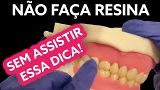 228 FAZ RESINA COMPOSTA ENTÃO ESSE VÍDEO É PARA VOCÊ [upl. by Ednihek260]