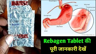 पेट में सूजन छाले गैस एसिडिटी 3 दिन में ठीक  rebagen tablet uses in hindi  rebamipide tablet hindi [upl. by Ahsiral108]