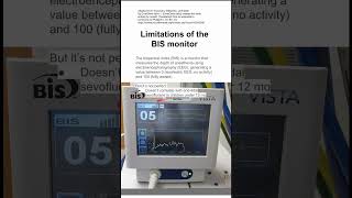 Limitations of the BIS monitor [upl. by Aziul927]