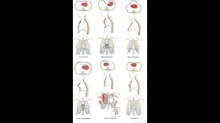 Differences between Malformation and Deformation in Anatomy pathology  Meaning and Examples [upl. by Eednam]