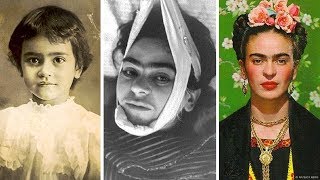 A Trágica História De Frida Kahlo [upl. by Kacie]