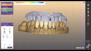 Millbox DentalWingsDwos Invivo FreeformPlus BlueSkyPlan Onyxceph CoDiagnostiX [upl. by Hartfield]