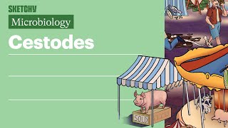 Cestodes Microbiology  USMLE Step 1  Sketchy Medical [upl. by Strage]