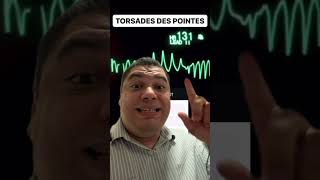 Como tratar a Torsades des Pointes cardiologia [upl. by Lipski]