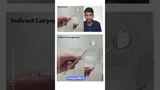 Laryngoscopy ent inicet neetpg [upl. by Yentruocal839]