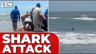 SHARK ATTACK in Texas DESTROYS womans leg leaves her hospitalized [upl. by Synn]