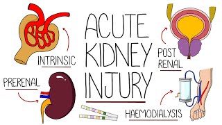 Understanding Acute Kidney Injury AKI Made Easy [upl. by Odraode]