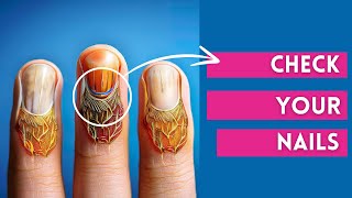 Lets Know What Your NAILS Says About YOUR HEALTH [upl. by Crary]