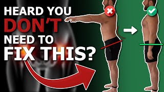 5 Reasons WHY you SHOULD Fix Your Anterior Pelvic Tilt [upl. by Anaitsirk]